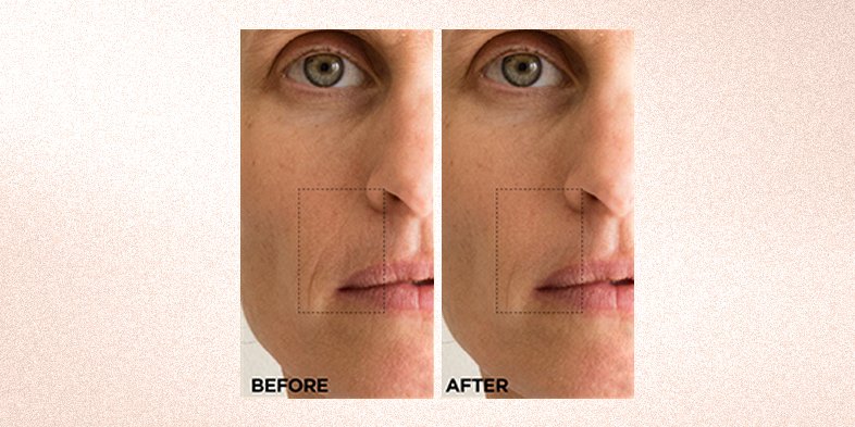 In-Article-best-anti-aging-skin-care-products_3